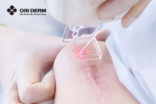 Các phương pháp nâng cao khác