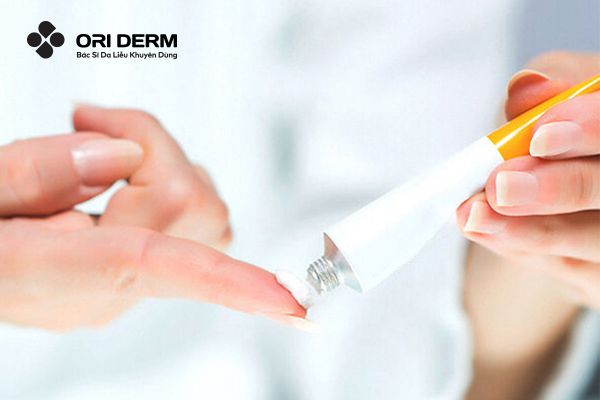 Cách chọn kem trị mụn