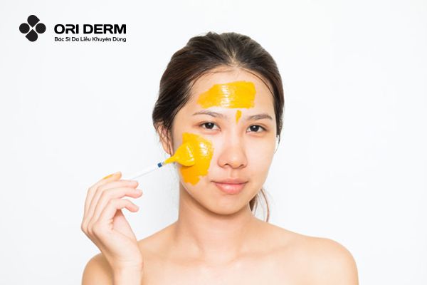 Cách trị sẹo rỗ tại nhà bằng nguyên liệu tự nhiên