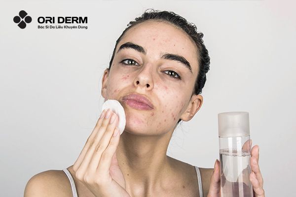 Lưu ý khi sử dụng toner cho da dầu mụn lỗ chân lông to