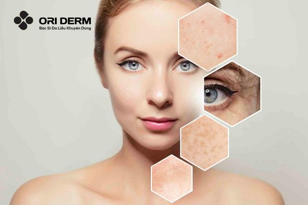 Chỉ định trường hợp nên tiêm meso