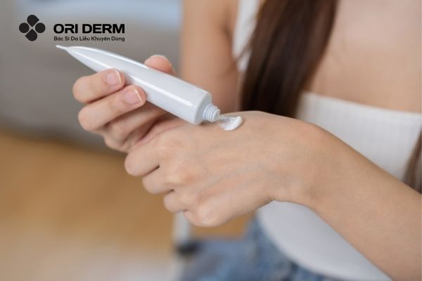 5 Tiêu chí lựa chọn thuốc trị sẹo rỗ phù hợp