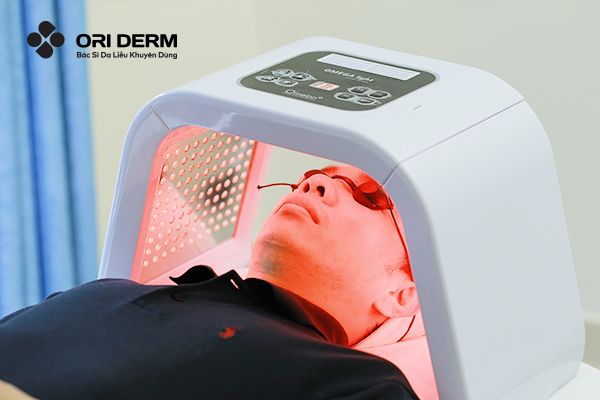 Cách trị ổ mụn viêm dưới da bằng ánh sáng sinh học