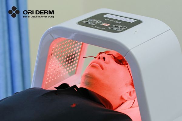 Cách trị mụn không viêm bằng ánh sáng sinh học