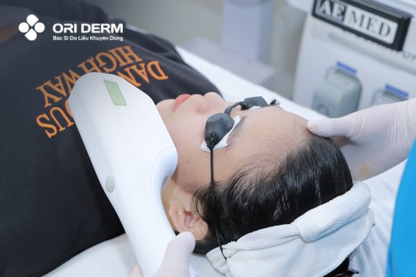 Cách xử lý mụn viêm đỏ bằng công nghệ cao