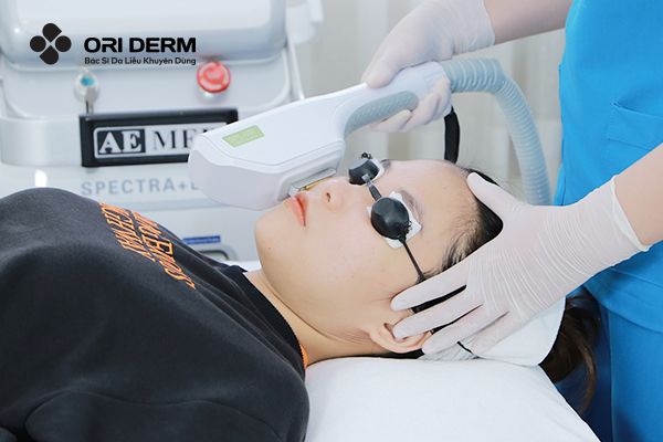 Cách trị mụn viêm ở mũi bằng công nghệ IPL