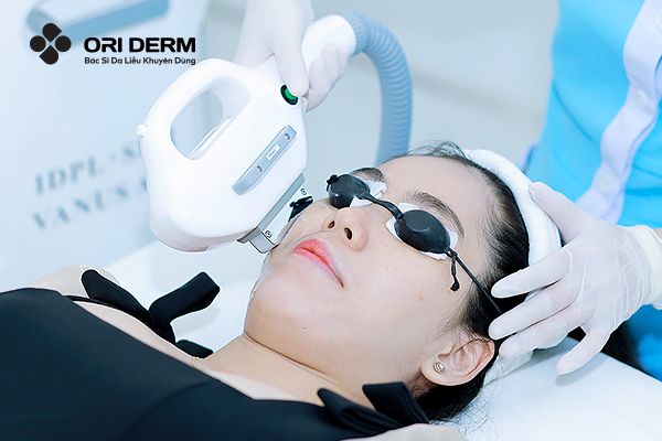 Công nghệ chiếu sáng IPL