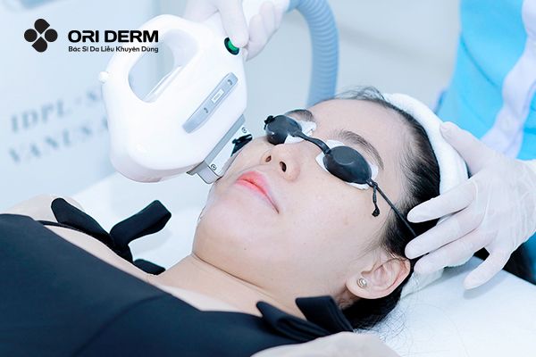 Điện di trị mụn viêm ở trán