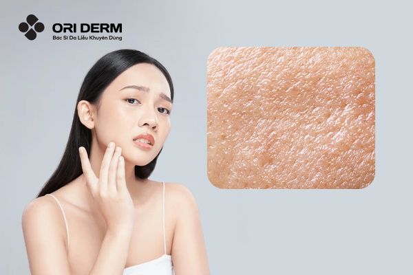 Đặc điểm của da dầu