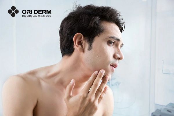 Đặc điểm về làn da của nam