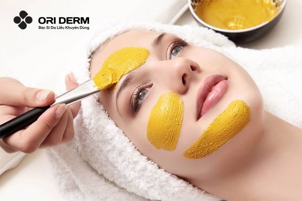 Đắp mặt nạ nghệ để cải thiện mụn viêm