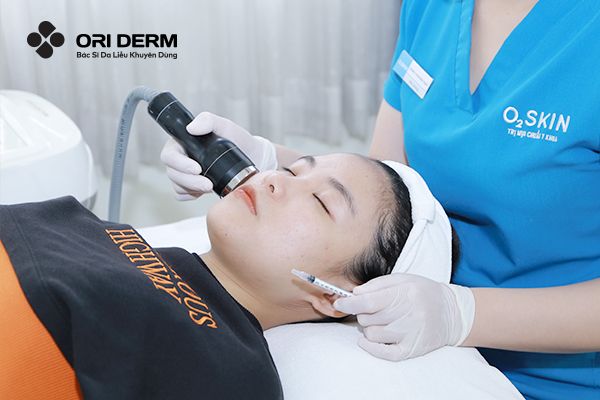 Trị mụn viêm dưới da bằng công nghệ chuyên sâu