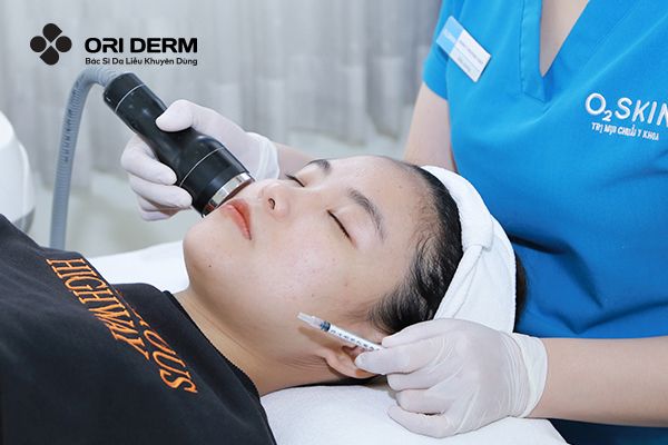 Điện di trị mụn