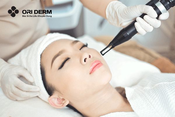 Làm đều màu da bằng phương pháp laser