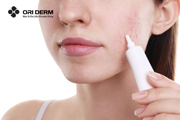 Dùng kem trị sẹo lõm