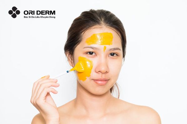 Dùng nghệ tươi trị sẹo lõm