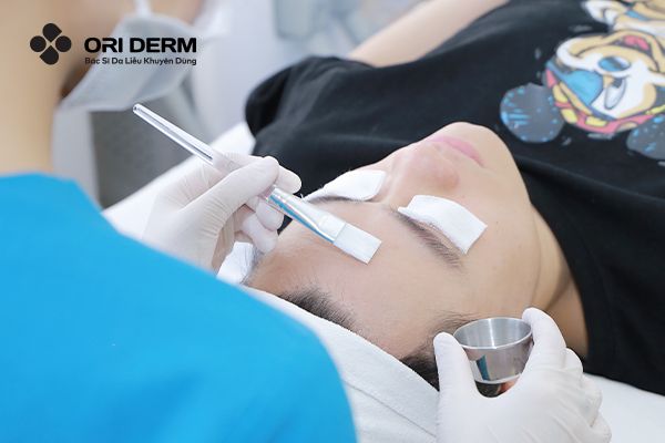 Đang Dùng Retinol Có Peel Da Được Không? An Toàn Hay Hại Da?