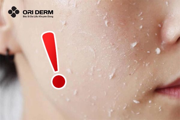 Tránh sử dụng BHA cùng lúc với các sản phẩm cùng công dụng