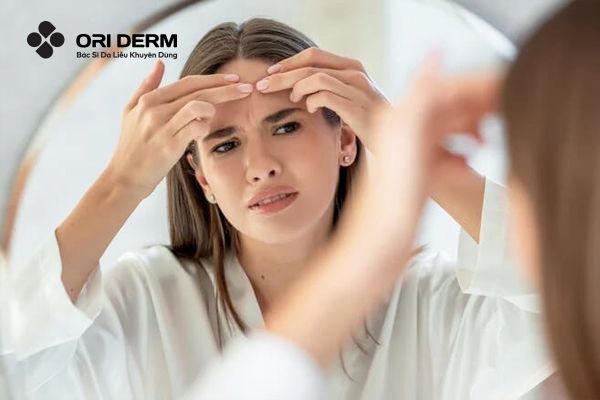 Nguyên nhân mụn mọc ở lông mày