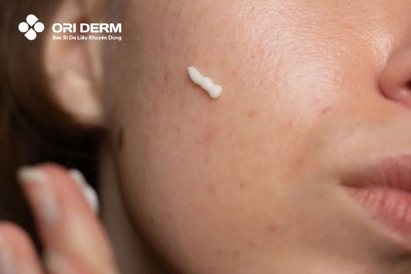 Cách điều chỉnh tần suất sử dụng retinol dựa trên phản ứng của da