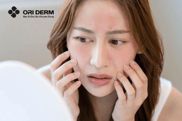 Nguyên nhân khiến da trở nên nhạy cảm