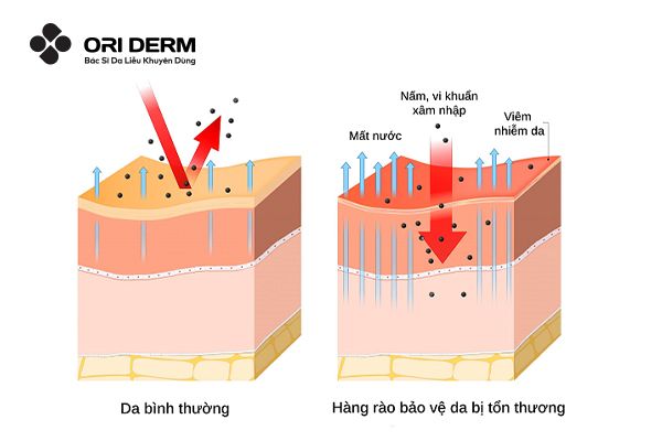 Hàng rào bảo vệ da là gì?