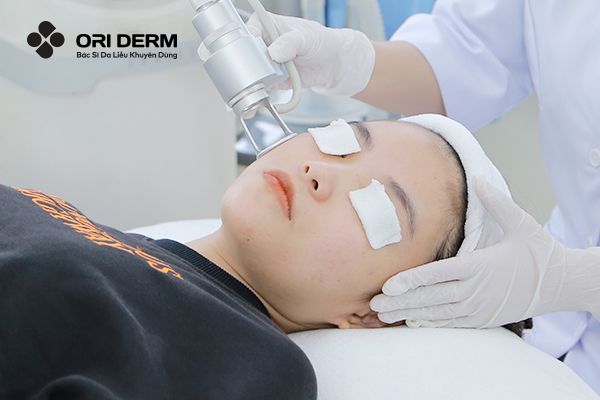 Laser Trị Thâm Mụn: Cơ Chế, Ưu - Nhược Điểm Và Quy Trình
