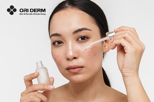 Vitamin C Có Trị Thâm Không? Những Lưu Ý Khi Dùng Vitamin C