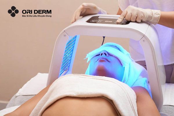 Cách trị mụn đầu trắng ẩn dưới da bằng công nghệ cao