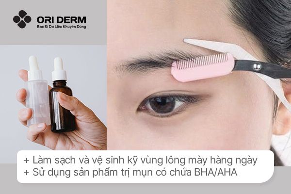 Hướng dẫn cách điều trị mụn mọc ở lông mày hiệu quả