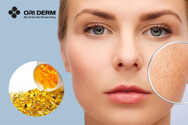 Gợi Ý Cách Sử Dụng Vitamin E Trị Sẹo Rỗ Hiệu Quả, Nhanh Chóng