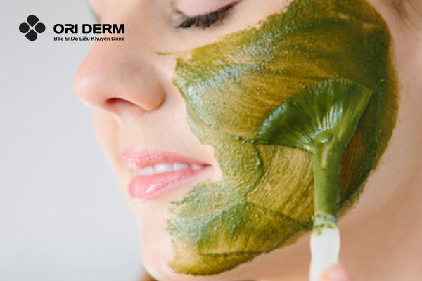 Phương pháp điều trị mụn nội tiết tự nhiên