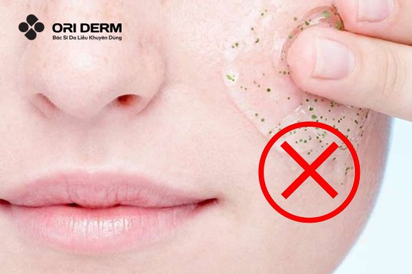 Típ để ngăn ngừa tình trạng thâm da sau liệu trình peel