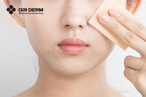 Kiểm soát dầu nhờn cho da mụn