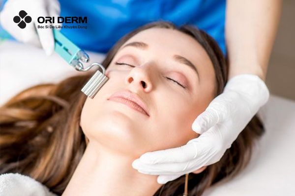 Lăn kim trị sẹo lõm