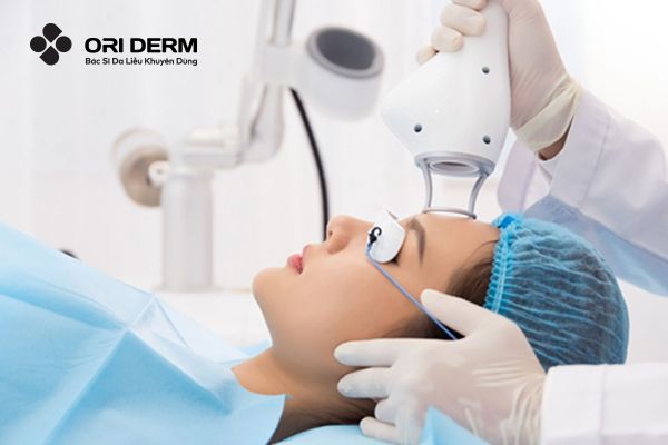 Laser Fractional CO2