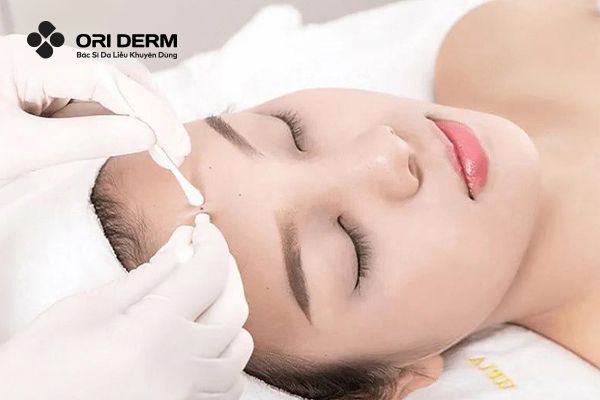 Lấy nhân mụn Y khoa