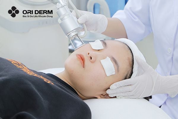 Liệu pháp laser xử lý mụn sưng viêm ở mũi