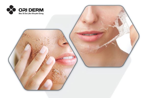 Phân loại các loại tẩy tế bào chết