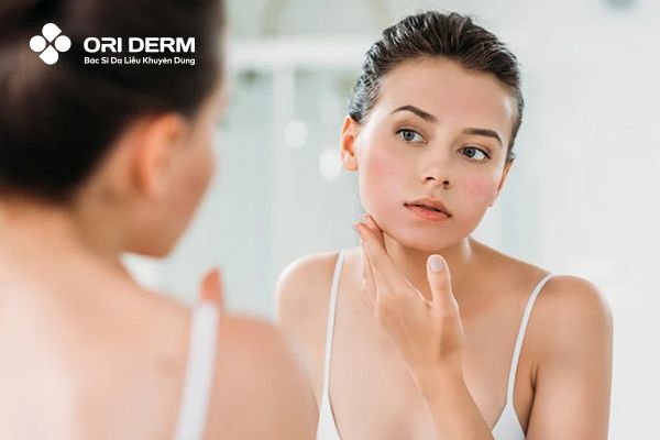 Lợi ích khi chọn đúng kem dưỡng phục hồi da mỏng