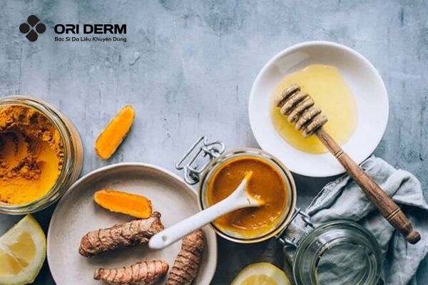 Trị sẹo rỗ bằng nghệ tươi kết hợp mật ong