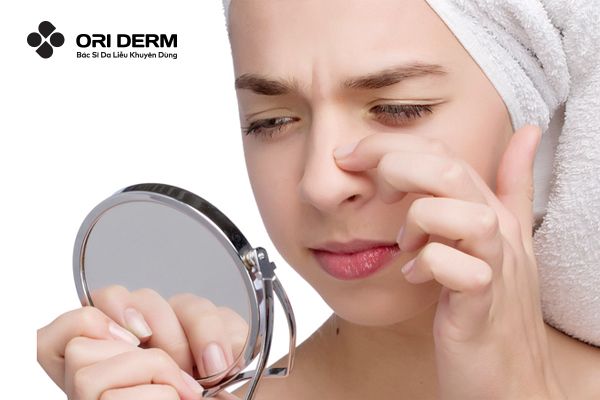 Mụn ẩn có tự hết được không?