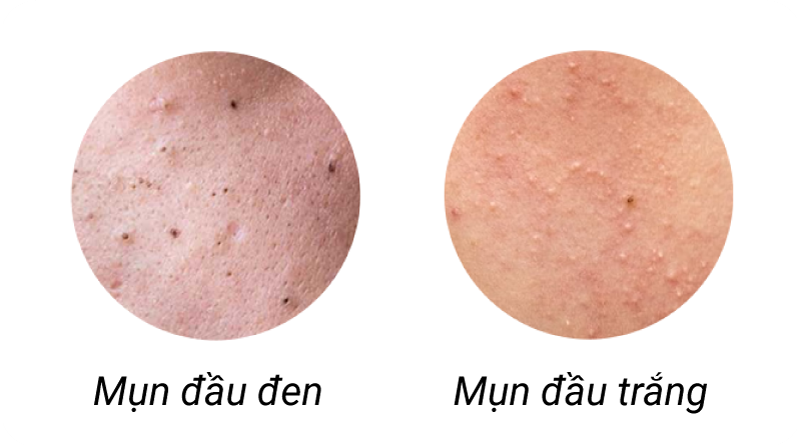 Ori Derm