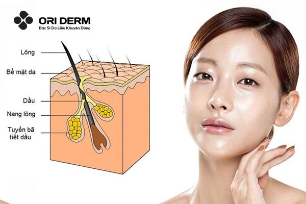 Mụn không viêm nguyên nhân do đâu?