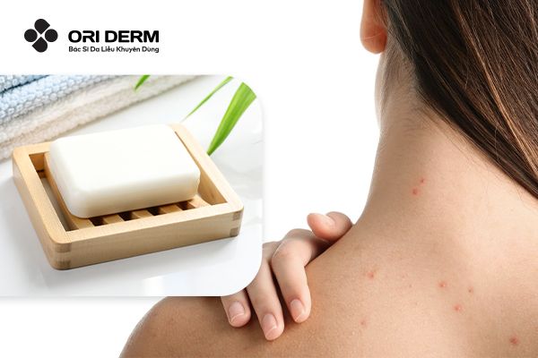 Top 7 Xà Phòng Trị Mụn Lưng Hiệu Quả Bạn Nên Thử