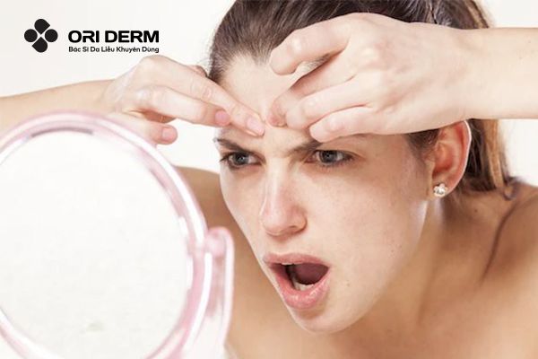 Mụn viêm bị vỡ nguyên nhân do đâu?