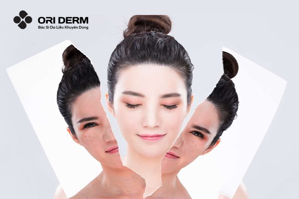 Hướng Dẫn Cách Phục Hồi Da Mặt Bị Hư Tổn Tại Nhà An Toàn