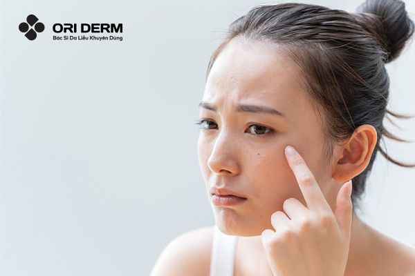 Nguyên nhân gây tình trạng da khô thiếu ẩm