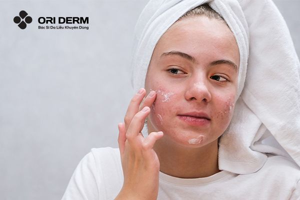 Đang dùng retinol có peel da được không?