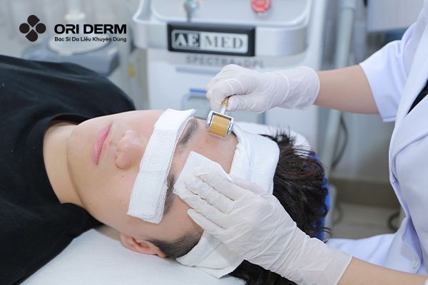 Da Mỏng Có Lăn Kim Được Không? Những Nguy Cơ Bạn Cần Biết